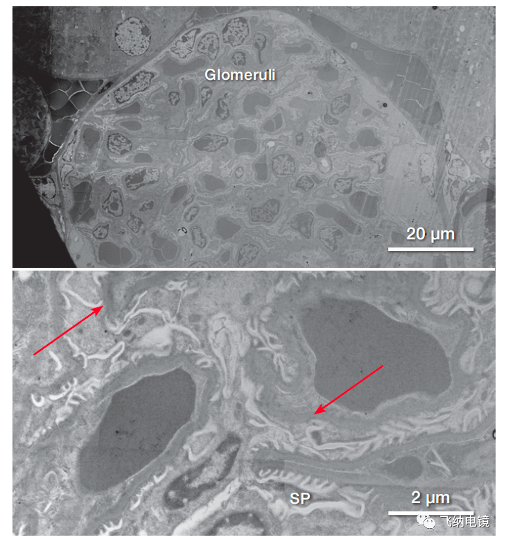 小鼠腎標(biāo)本樣品（腎小球和臨近的腎血管）的 STEM 圖